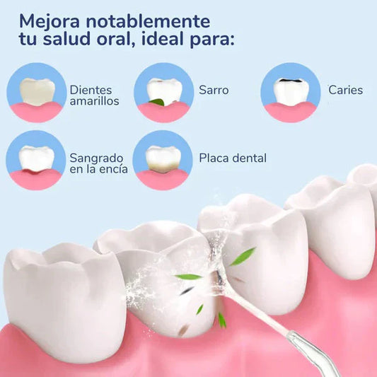 HydroPik Q-Series: Sistema de Limpieza Dental 360°